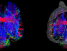 Echidna brain diffusion tensor imaging DTI