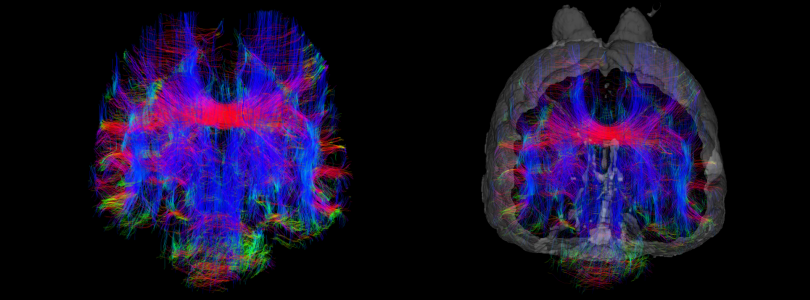 Echidna brain diffusion tensor imaging DTI